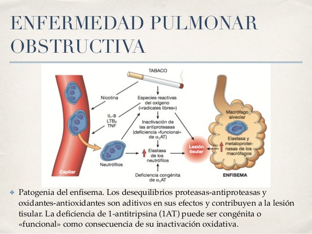Fibrosis quistica pulmonar fisiopatologia pdf free